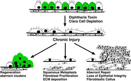 Schematic process of lung injury and repair after acute and chronic Clara cell depletion.